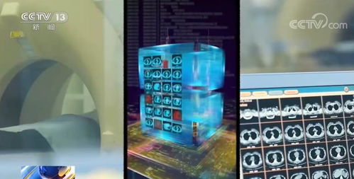 科技创新新机遇 人工智能开启规模化应用时代